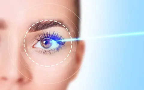 Lasik
