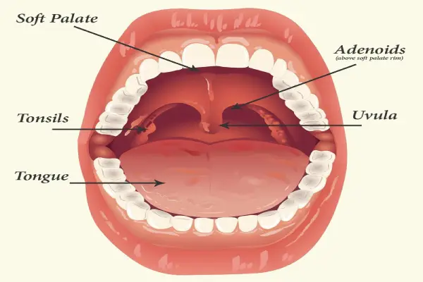 Tonsils and adenoids